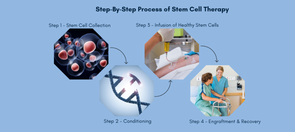 stem cell therapy